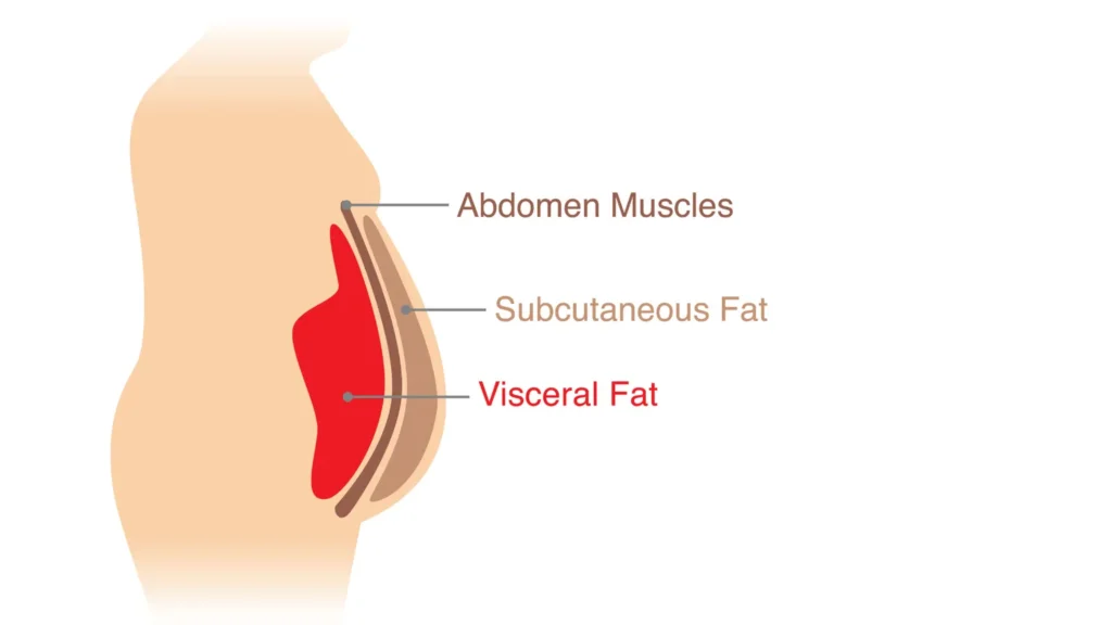 Types of body fat: subcutaneous vs. visceral"